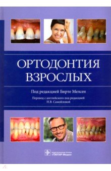 Ортодонтия взрослых